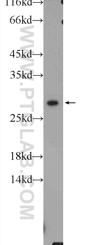 Western Blot (WB) analysis of A431 cells using CAPNS1 Polyclonal antibody (25057-1-AP)