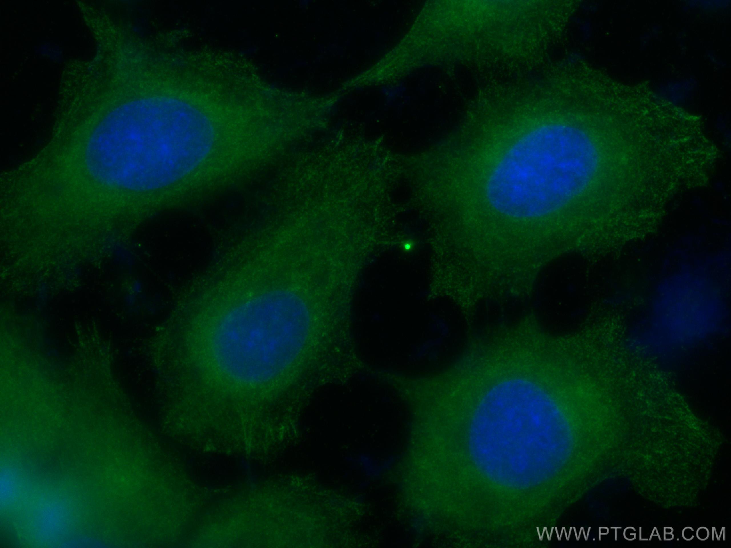 Immunofluorescence (IF) / fluorescent staining of A431 cells using CAPNS1 Monoclonal antibody (67838-1-Ig)