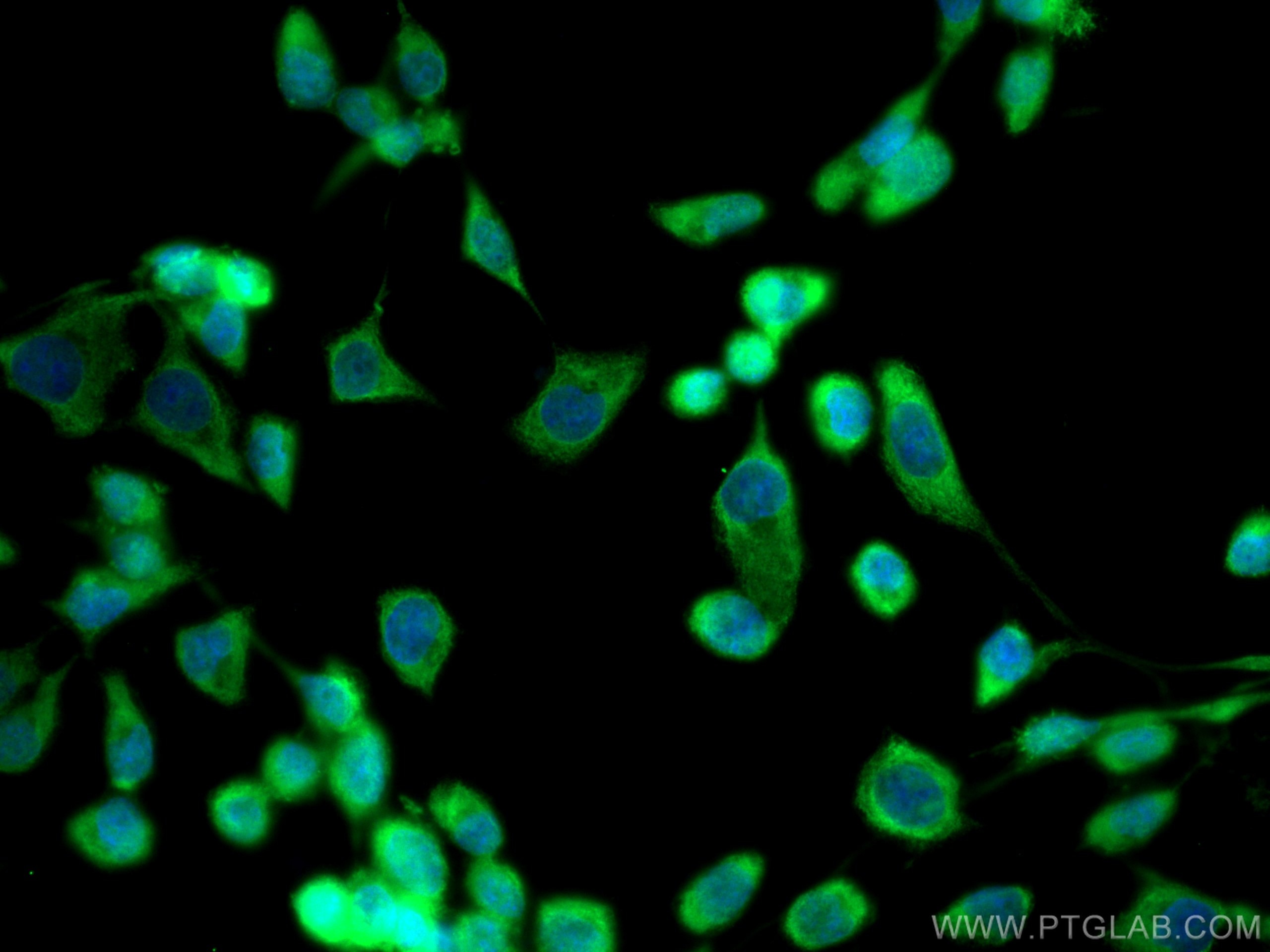 Immunofluorescence (IF) / fluorescent staining of A431 cells using CoraLite® Plus 488-conjugated CAPNS1 Monoclonal an (CL488-67838)