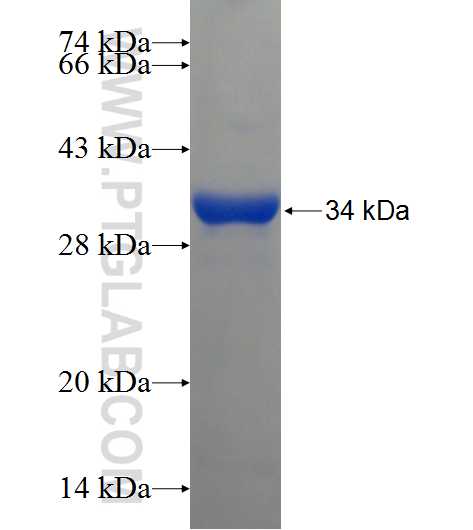 CAPNS1 fusion protein Ag21885 SDS-PAGE