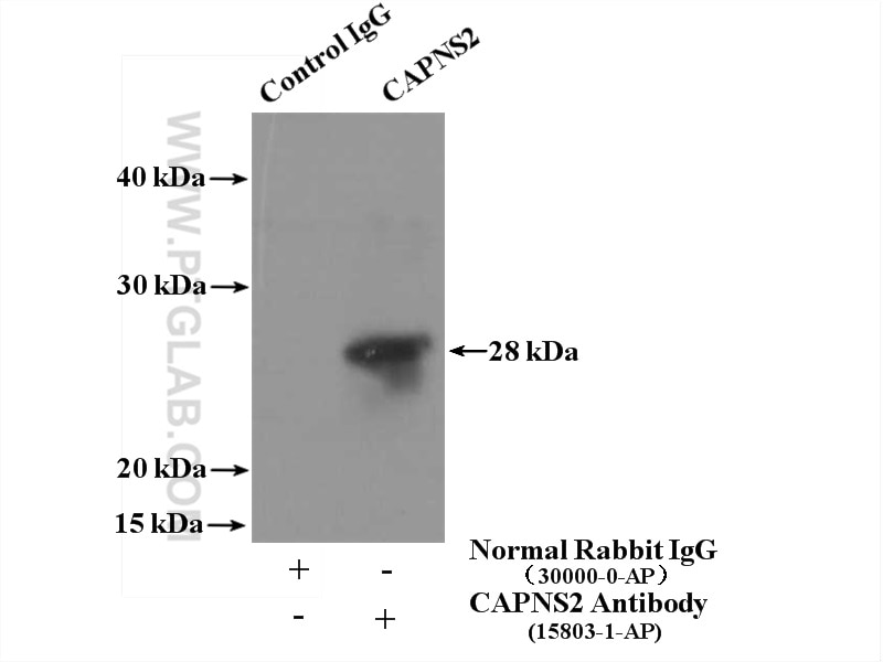 Immunoprecipitation (IP) experiment of mouse skin tissue using Calpain S2 Polyclonal antibody (15803-1-AP)