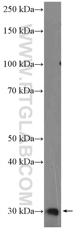 Western Blot (WB) analysis of rat skin tissue using Calpain S2 Polyclonal antibody (15803-1-AP)