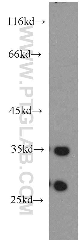 WB analysis of mouse skin using 15803-1-AP