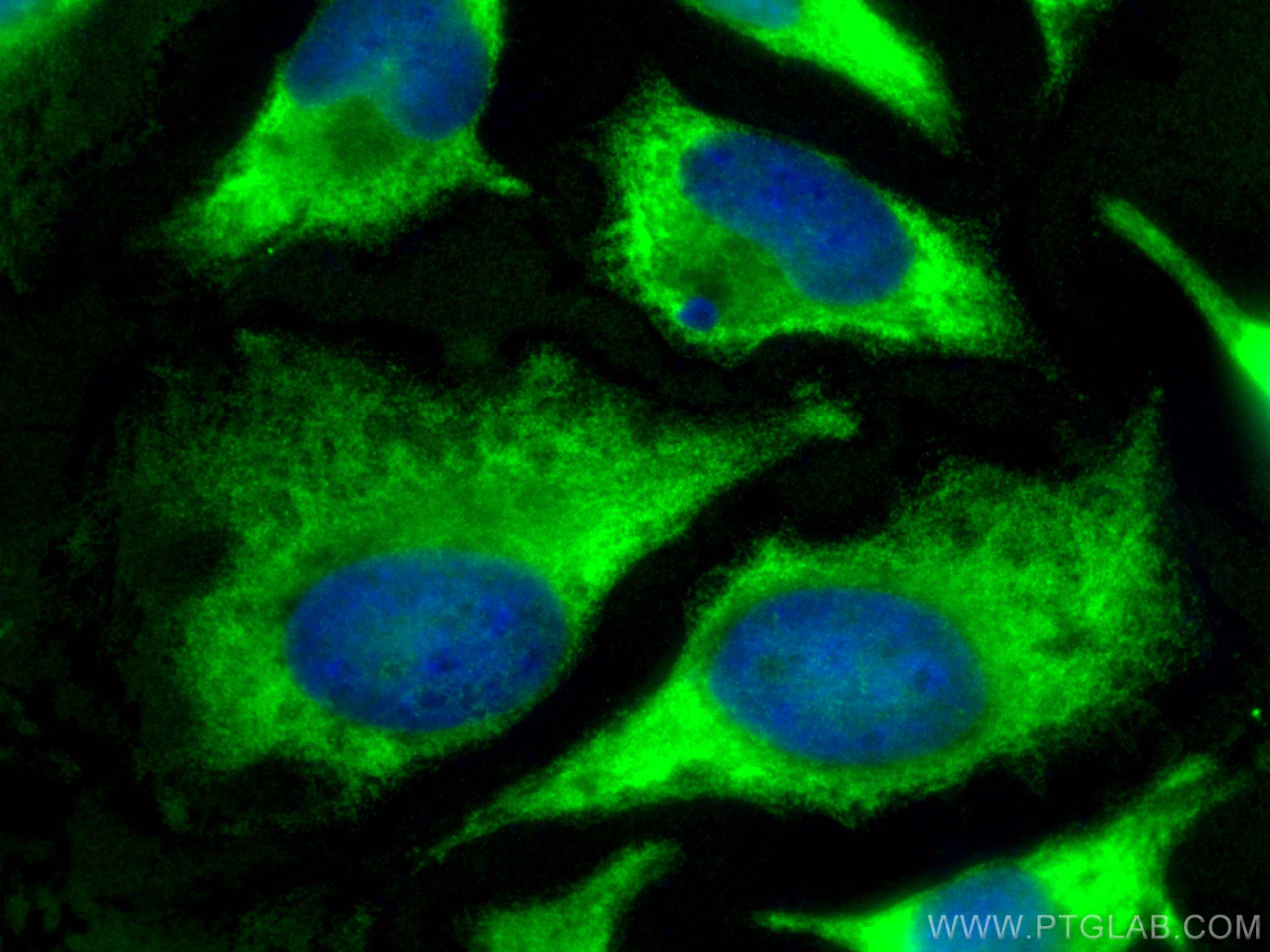 Immunofluorescence (IF) / fluorescent staining of HeLa cells using CAPRIN1 Polyclonal antibody (15112-1-AP)