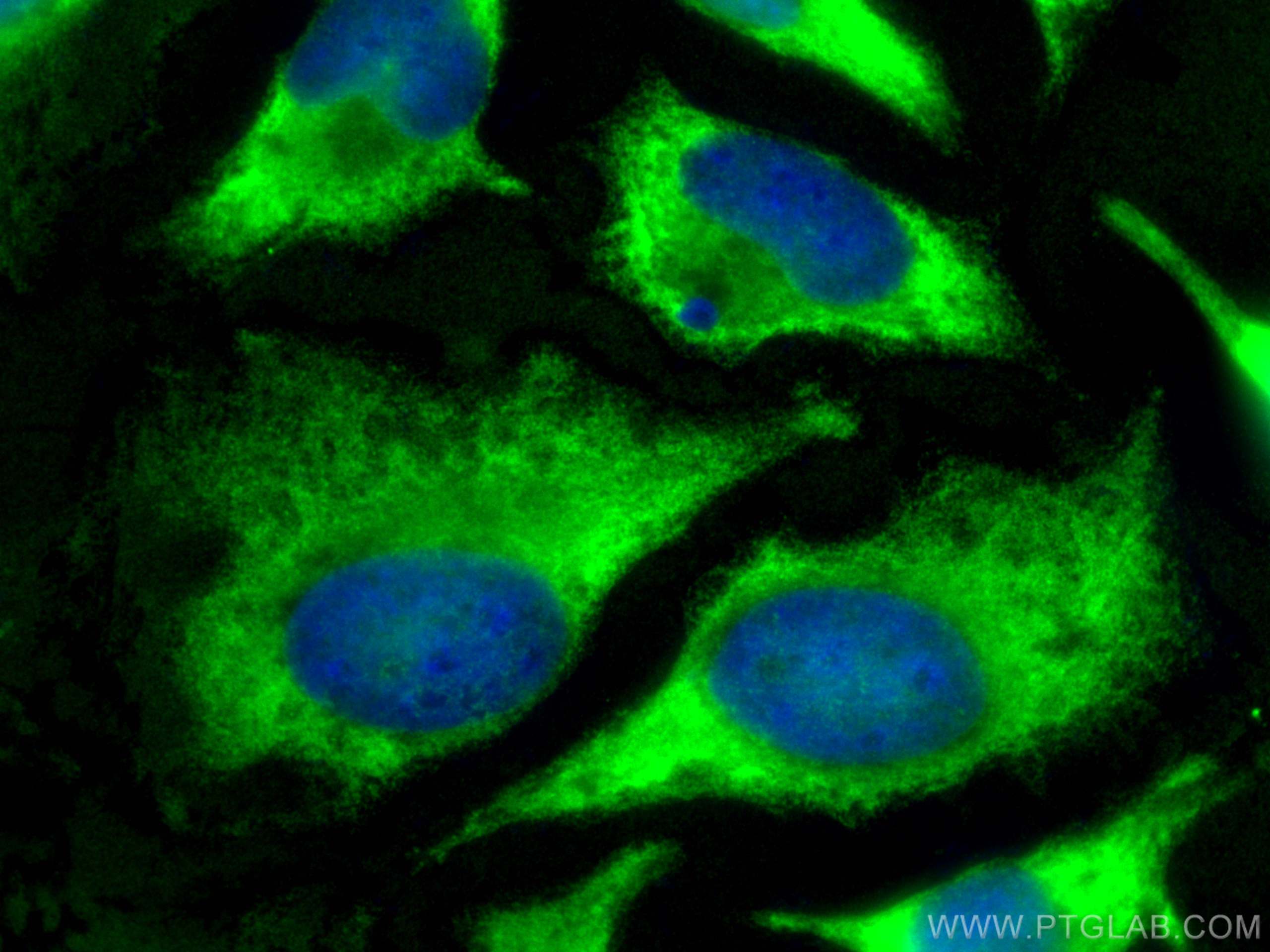 IF Staining of HeLa using 15112-1-AP