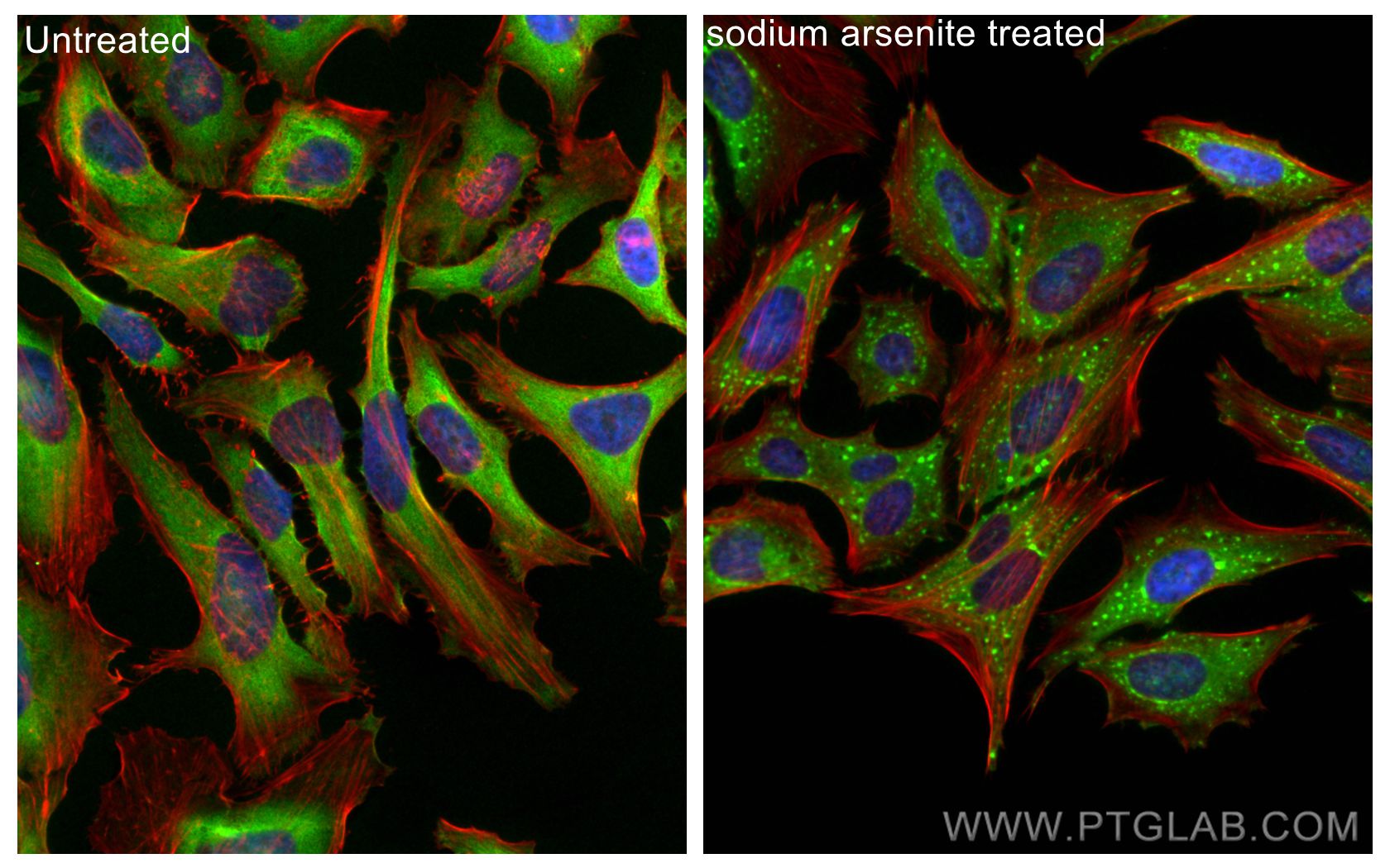 Immunofluorescence (IF) / fluorescent staining of HeLa cells using CAPRIN1 Polyclonal antibody (15112-1-AP)