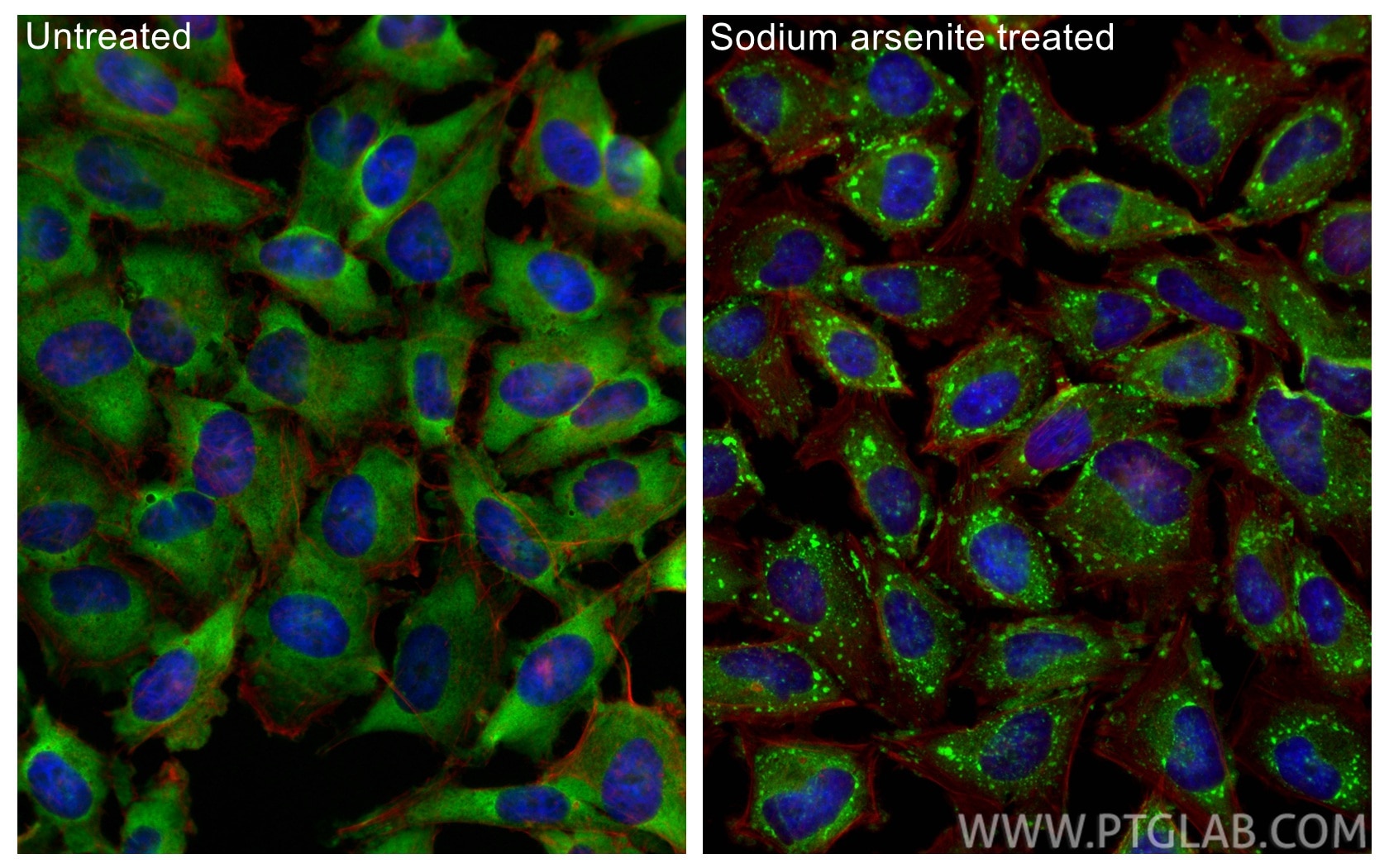 Immunofluorescence (IF) / fluorescent staining of HeLa cells using CAPRIN1 Polyclonal antibody (15112-1-AP)