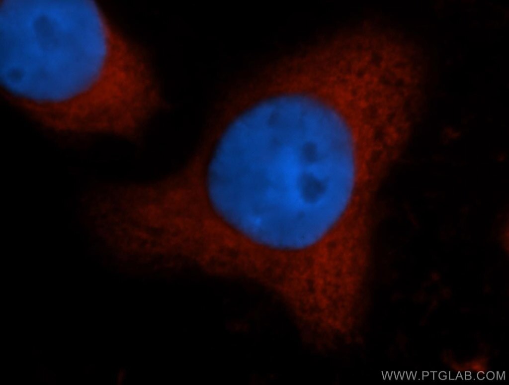 IF Staining of HeLa using 15112-1-AP