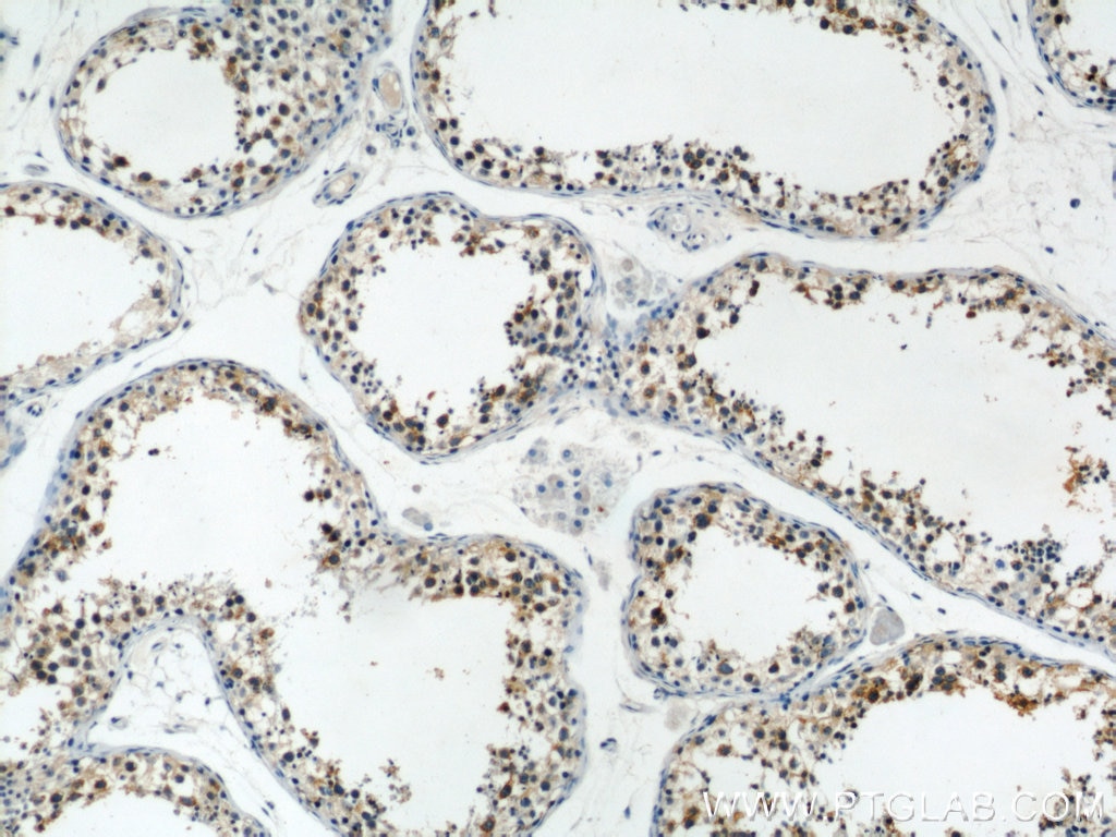 IHC staining of human testis using 15112-1-AP