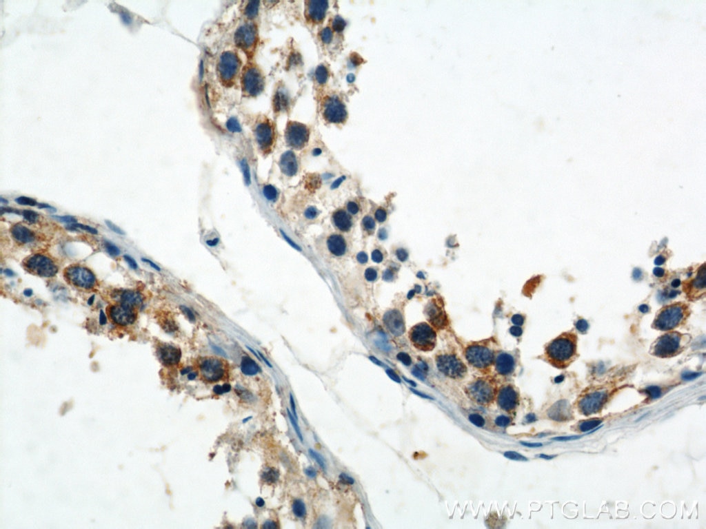 Immunohistochemistry (IHC) staining of human testis tissue using CAPRIN1 Polyclonal antibody (15112-1-AP)