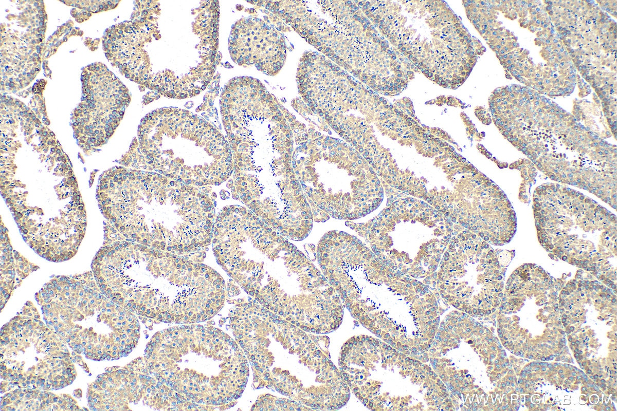 Immunohistochemistry (IHC) staining of mouse testis tissue using CAPRIN1 Polyclonal antibody (15112-1-AP)