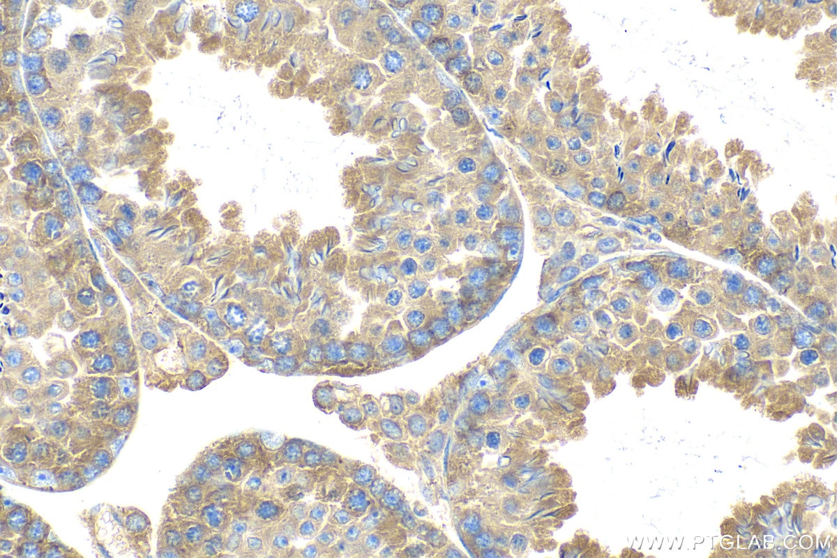 Immunohistochemistry (IHC) staining of mouse testis tissue using CAPRIN1 Polyclonal antibody (15112-1-AP)