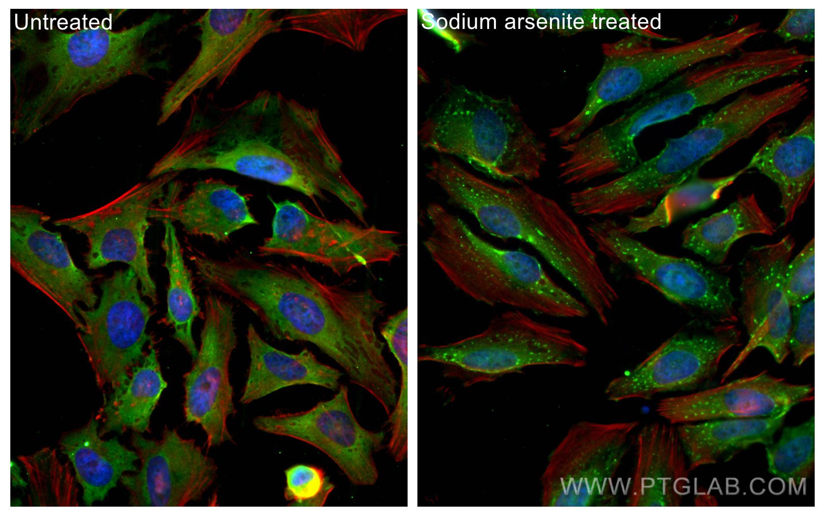 Immunofluorescence (IF) / fluorescent staining of HeLa cells using CAPRIN1 Monoclonal antibody (66352-1-Ig)