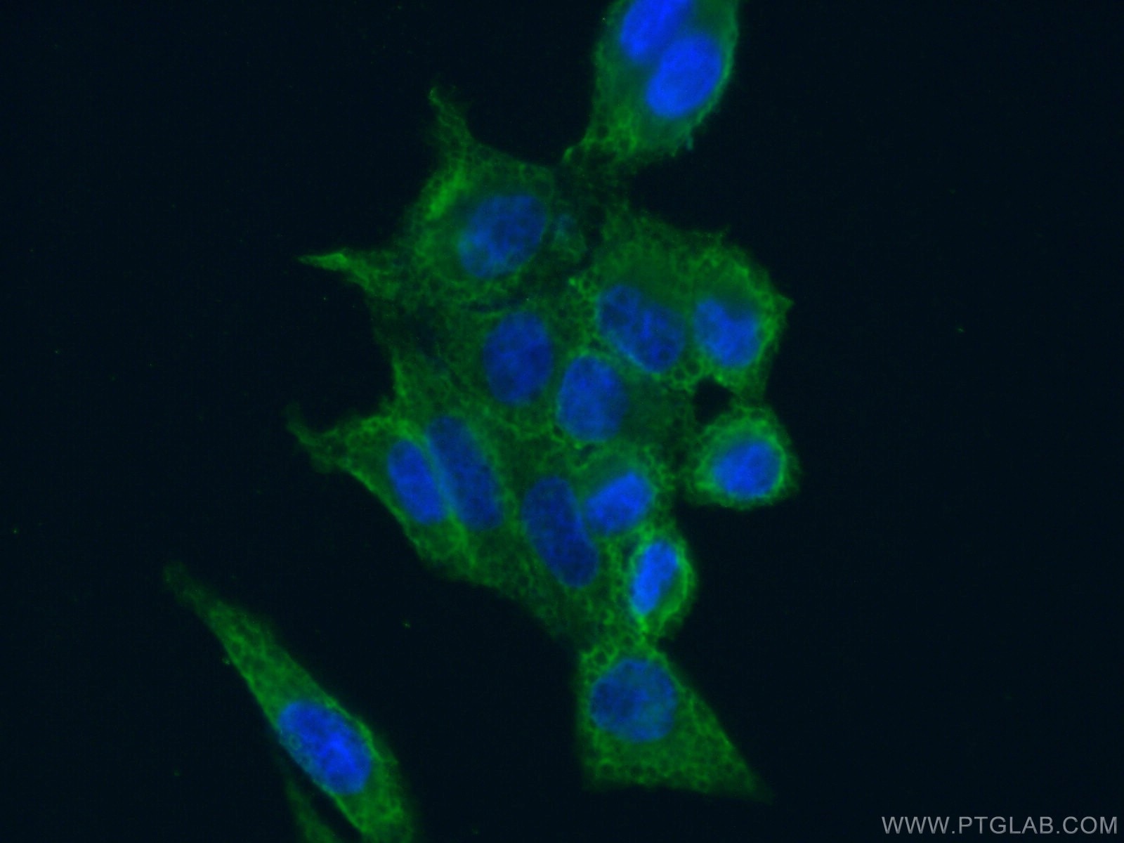 Immunofluorescence (IF) / fluorescent staining of HeLa cells using CAPRIN1 Monoclonal antibody (66352-1-Ig)