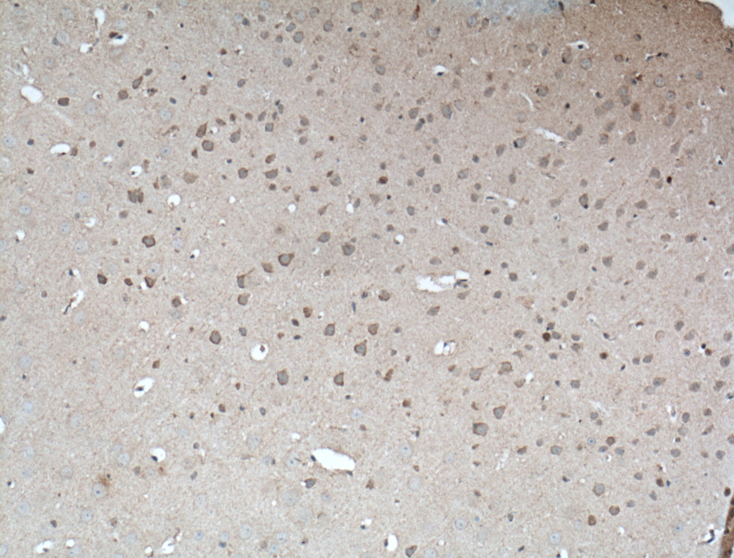 Immunohistochemistry (IHC) staining of mouse brain tissue using CAPRIN1 Monoclonal antibody (66352-1-Ig)