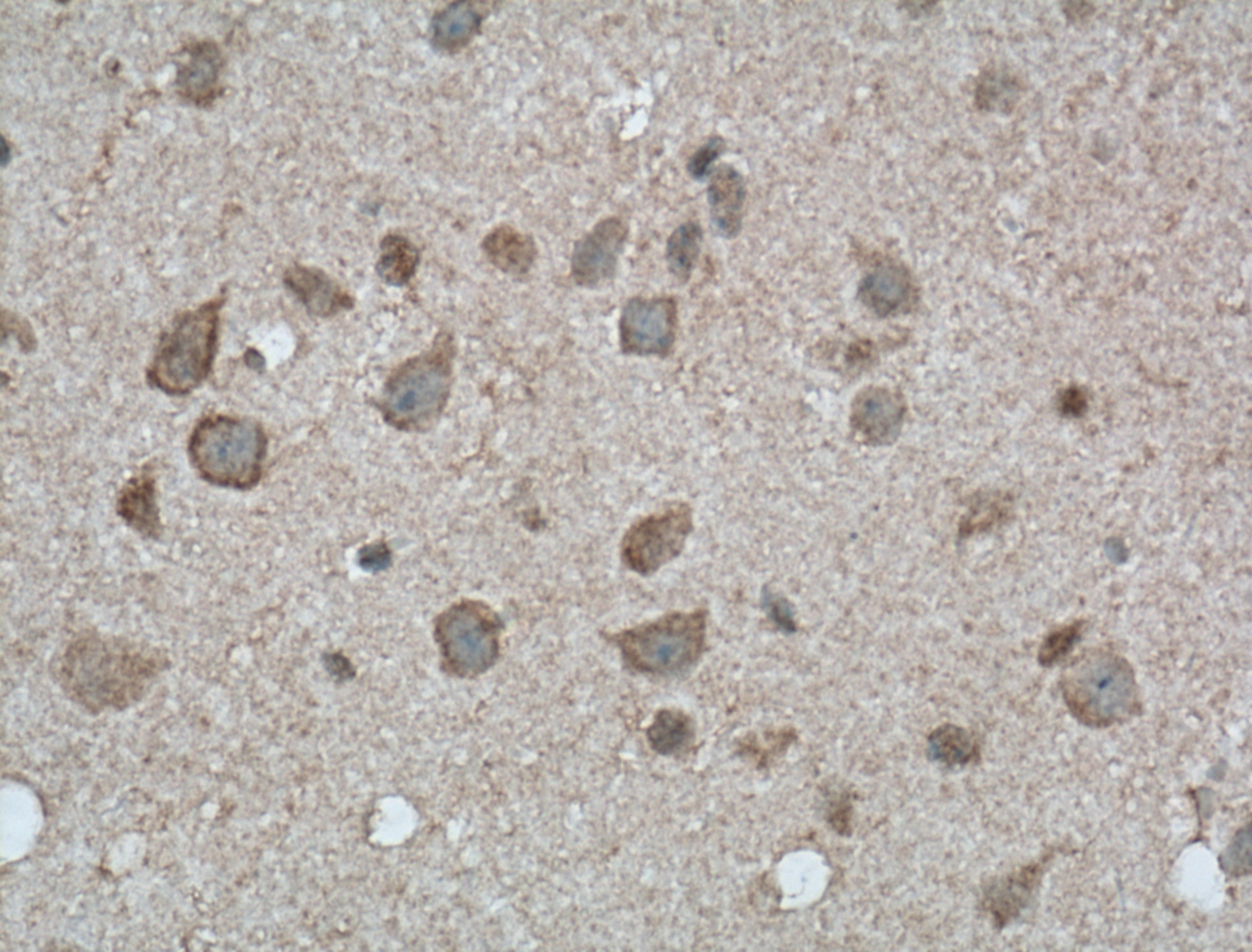 Immunohistochemistry (IHC) staining of mouse brain tissue using CAPRIN1 Monoclonal antibody (66352-1-Ig)