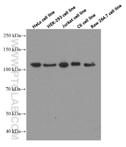 CAPRIN1 Monoclonal antibody