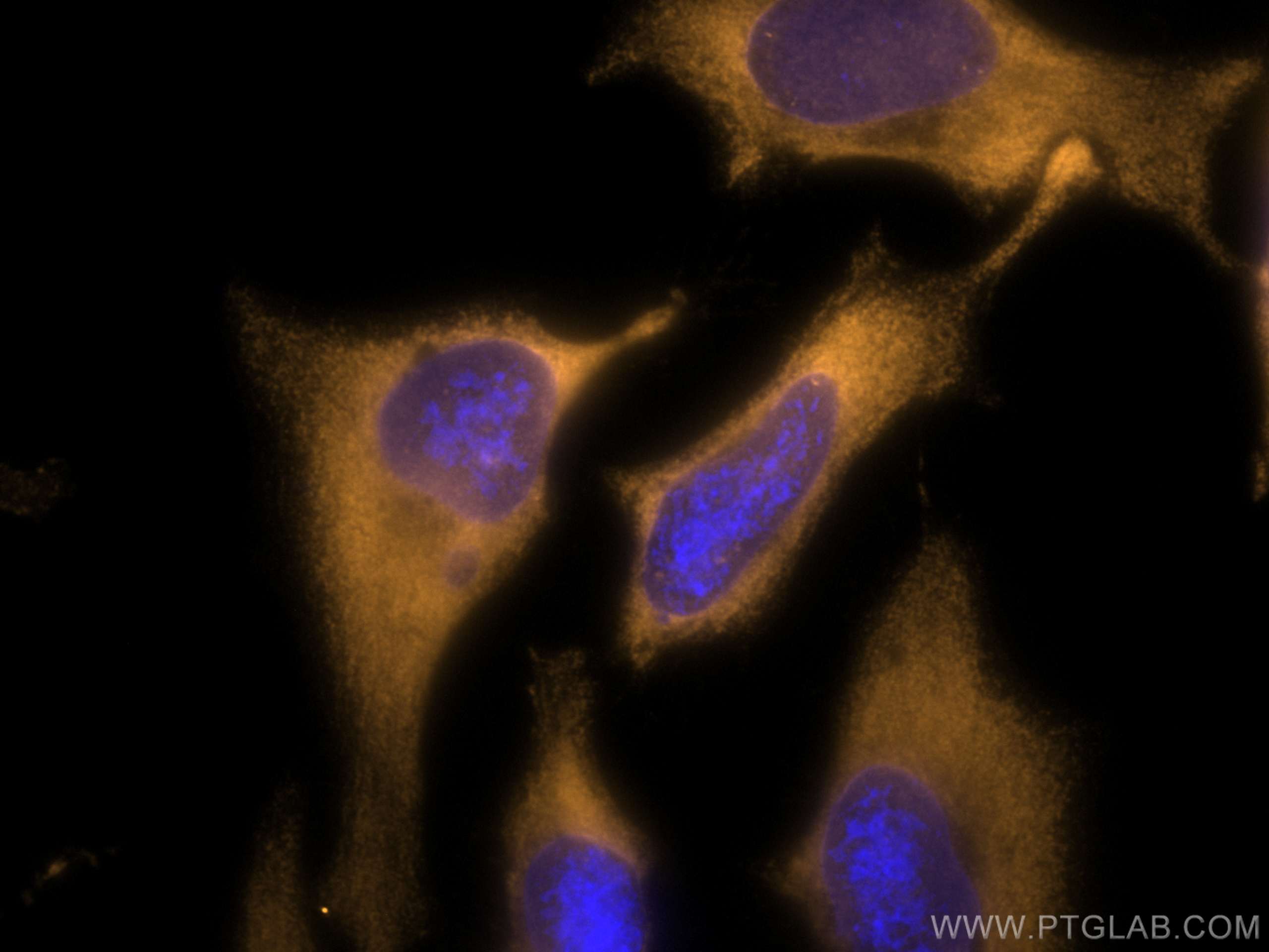 Immunofluorescence (IF) / fluorescent staining of HeLa cells using CoraLite®555-conjugated CAPRIN1 Monoclonal antibod (CL555-66352)