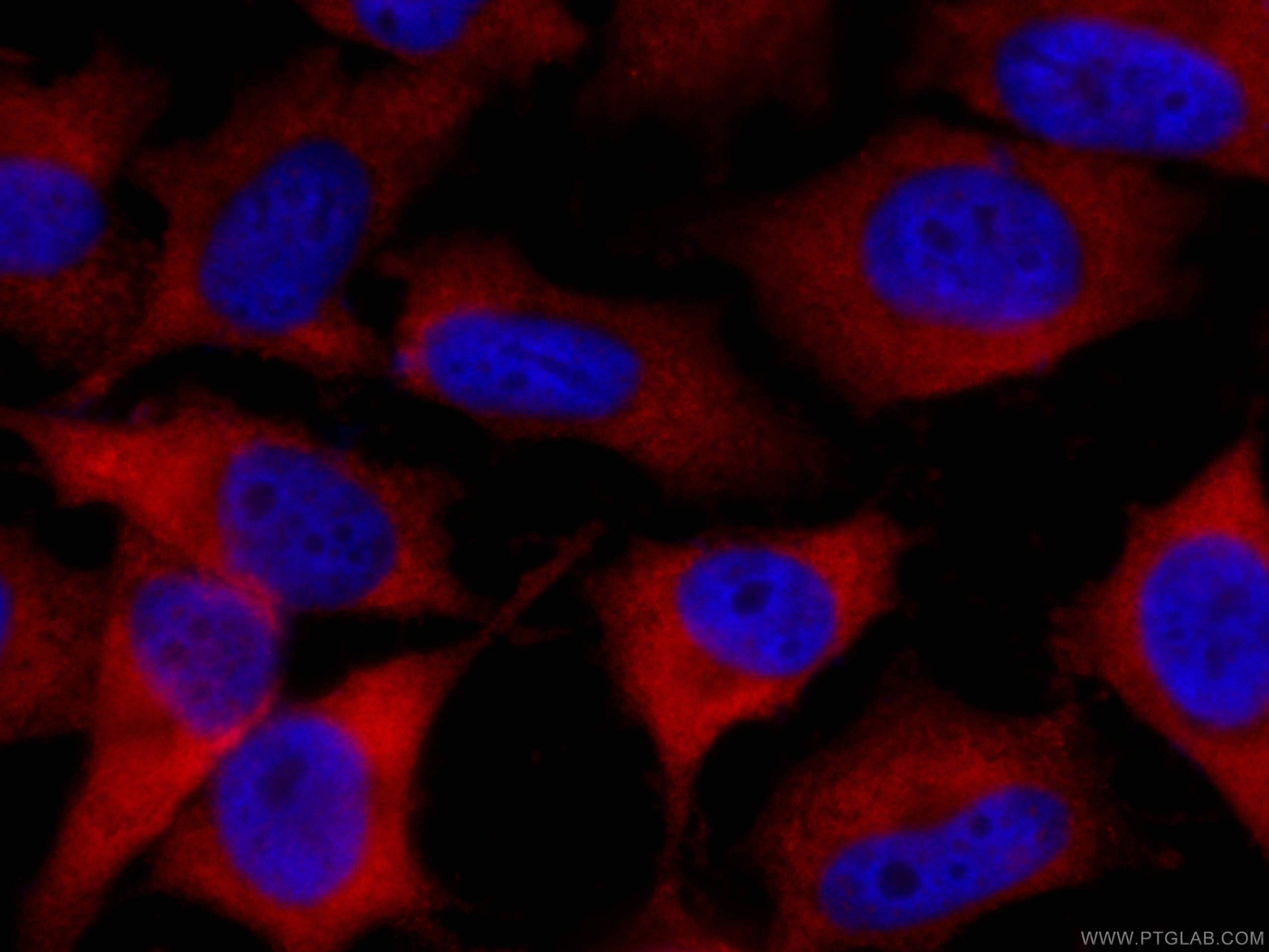 Immunofluorescence (IF) / fluorescent staining of HeLa cells using CoraLite®594-conjugated CAPRIN1 Monoclonal antibod (CL594-66352)