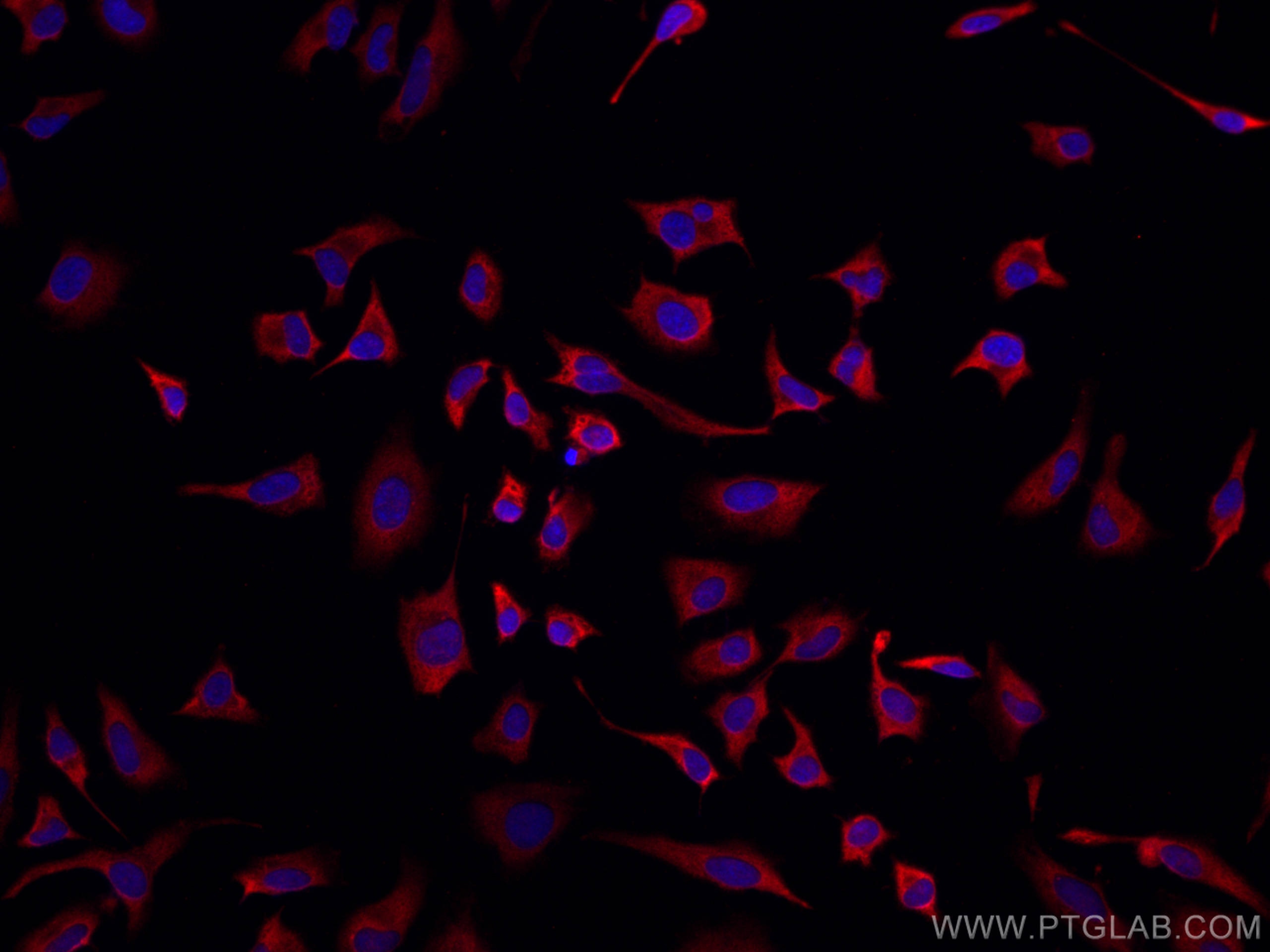 Immunofluorescence (IF) / fluorescent staining of HeLa cells using CoraLite®594-conjugated CAPRIN1 Monoclonal antibod (CL594-66352)