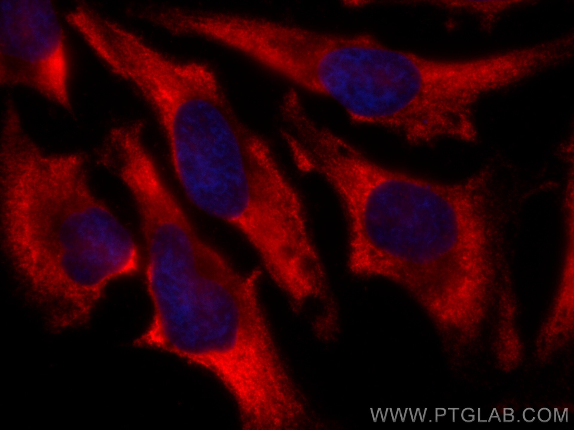 Immunofluorescence (IF) / fluorescent staining of HeLa cells using CoraLite®594-conjugated CAPRIN1 Monoclonal antibod (CL594-66352)