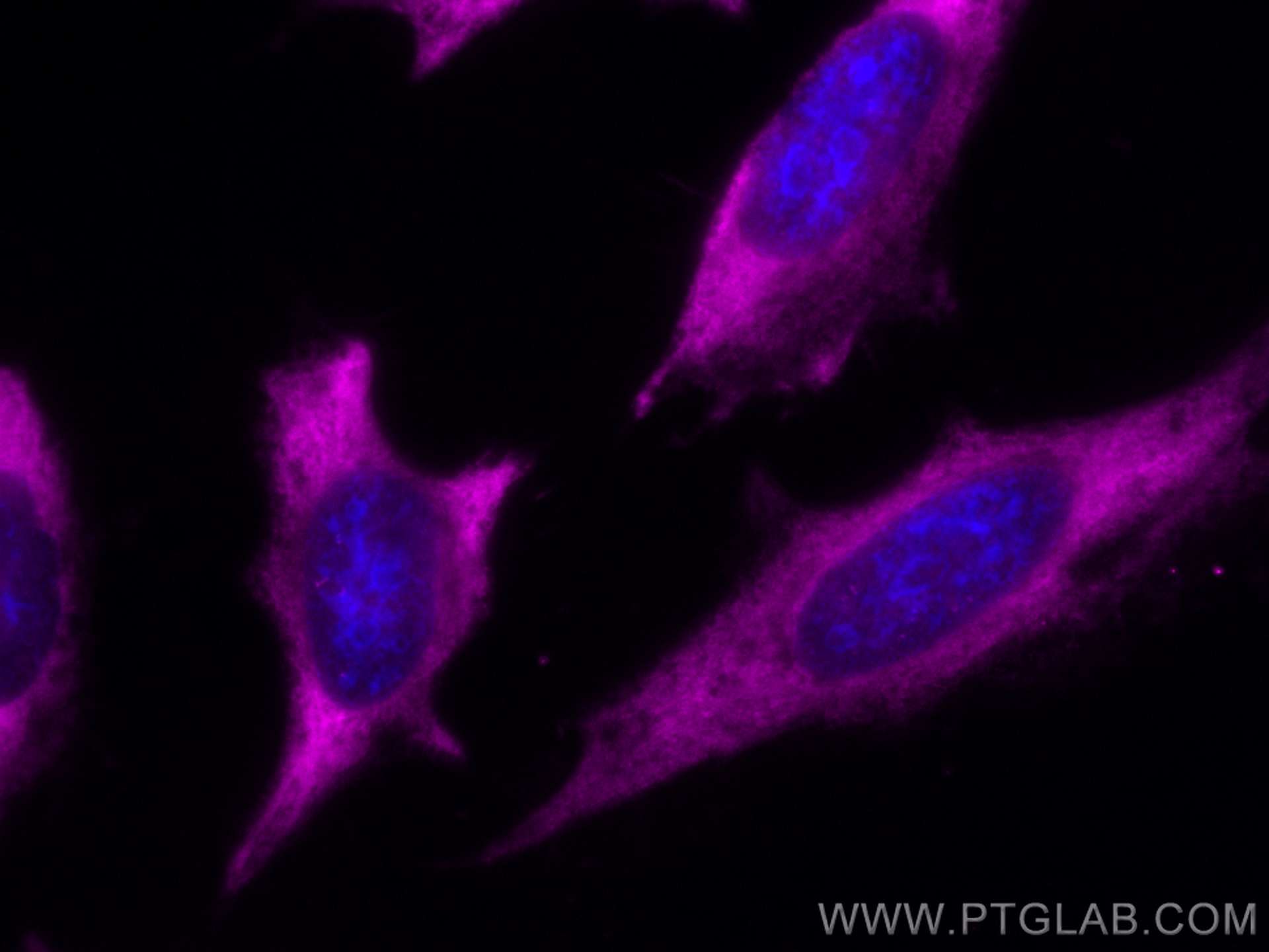 Immunofluorescence (IF) / fluorescent staining of HeLa cells using CoraLite® Plus 647-conjugated CAPRIN1 Monoclonal a (CL647-66352)