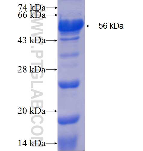 CAPRIN1 fusion protein Ag7413 SDS-PAGE