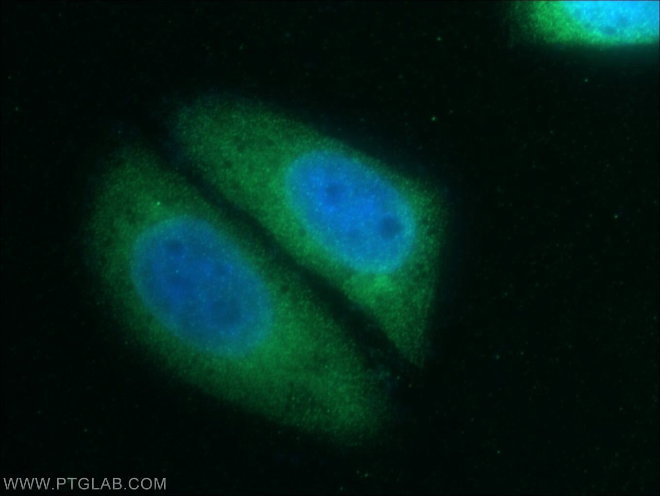 IF Staining of HepG2 using 20766-1-AP