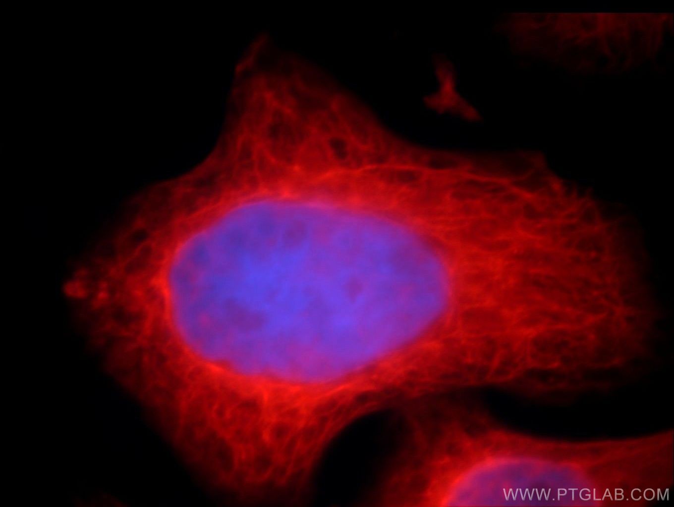 Immunofluorescence (IF) / fluorescent staining of HepG2 cells using CAPRIN2 Polyclonal antibody (20766-1-AP)