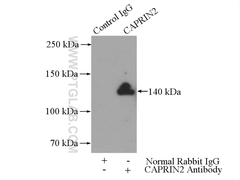 Immunoprecipitation (IP) experiment of SH-SY5Y cells using CAPRIN2 Polyclonal antibody (20766-1-AP)