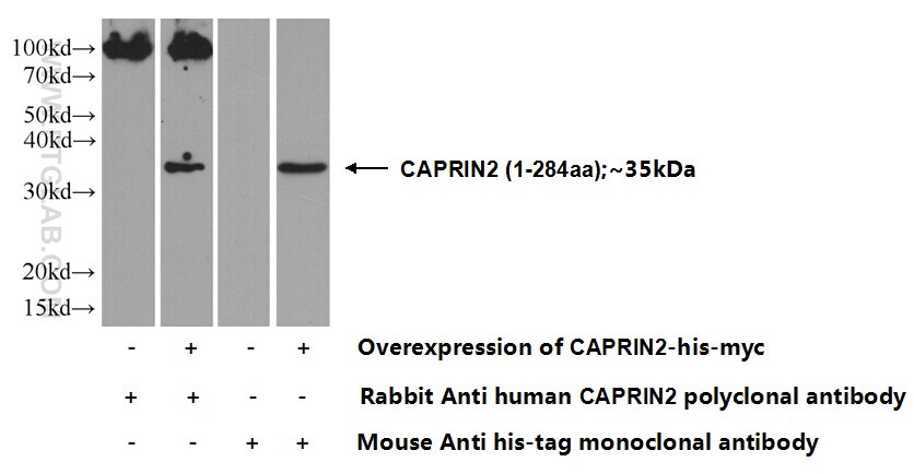Western Blot (WB) analysis of HEK-293 cells using CAPRIN2 Polyclonal antibody (20766-1-AP)