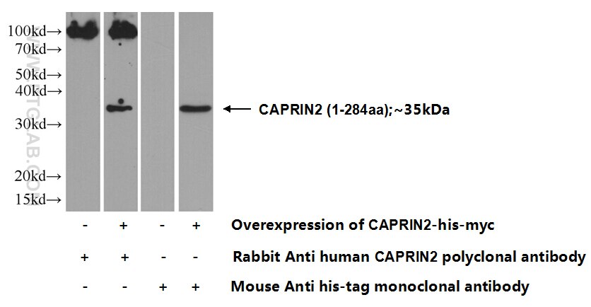 Western Blot (WB) analysis of HEK-293 cells using CAPRIN2 Polyclonal antibody (20766-1-AP)