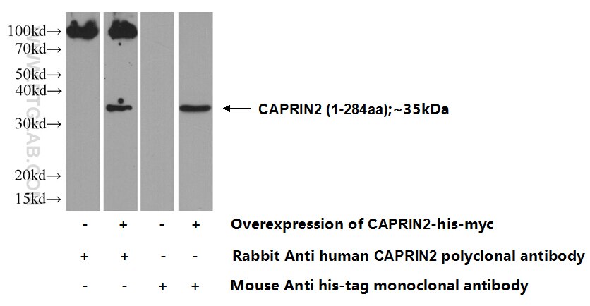 WB analysis of HEK-293 using 20766-1-AP