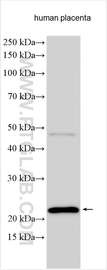 Western Blot (WB) analysis of various lysates using Calcyphosine Polyclonal antibody (16926-1-AP)
