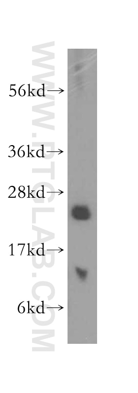 Western Blot (WB) analysis of human spleen tissue using Calcyphosine Polyclonal antibody (16926-1-AP)