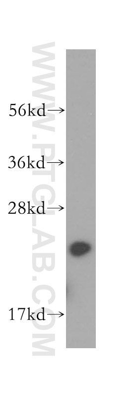 Western Blot (WB) analysis of human colon tissue using Calcyphosine Polyclonal antibody (16926-1-AP)