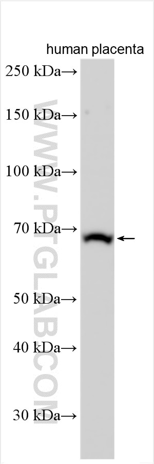 Western Blot (WB) analysis of various lysates using Calcyphosine 2 Polyclonal antibody (11924-1-AP)