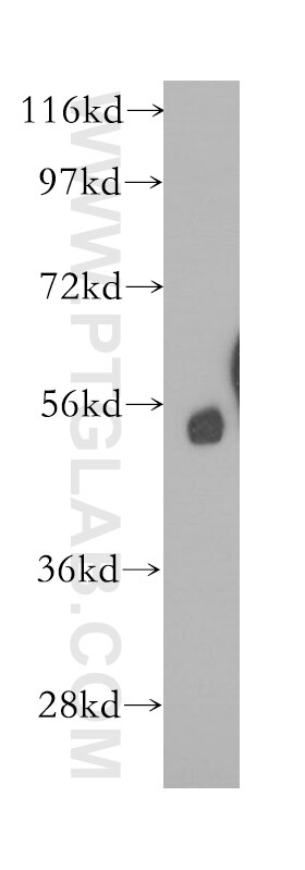 Calcyphosine 2