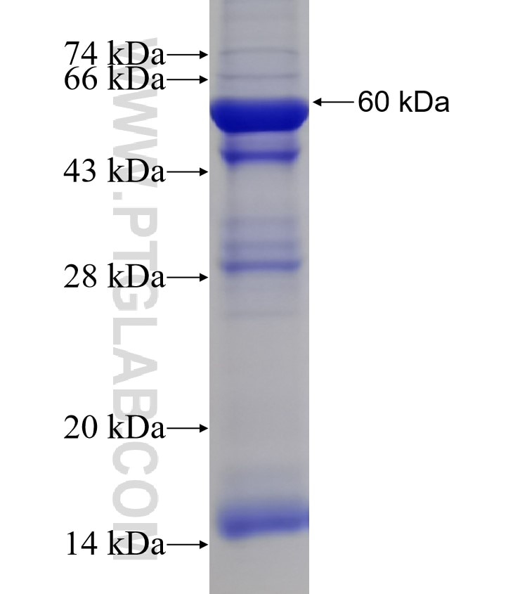 CAPS2 fusion protein Ag2571 SDS-PAGE