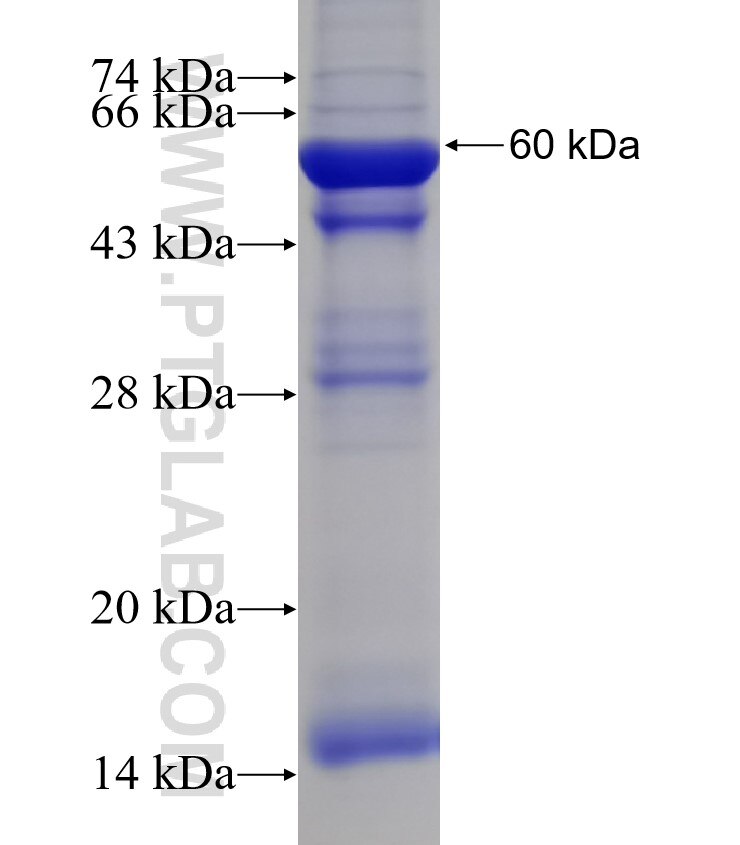 CAPS2 fusion protein Ag2571 SDS-PAGE