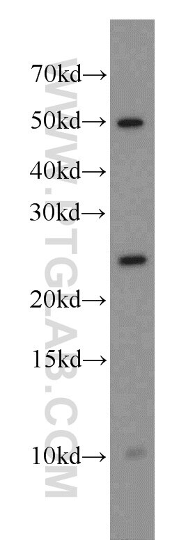 Western Blot (WB) analysis of mouse lung tissue using CAPSL Polyclonal antibody (17174-1-AP)