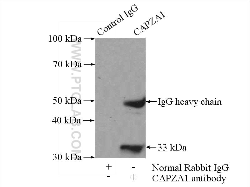 Immunoprecipitation (IP) experiment of SH-SY5Y cells using CAPZA1 Polyclonal antibody (11806-1-AP)