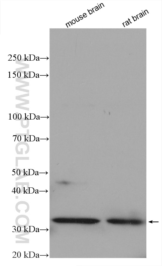 Various lysates were subjected to SDS PAGE followed by western blot with 11806-1-AP (CAPZA1 antibody) at dilution of 1:2000 incubated at room temperature for 1.5 hours. Western Blot (WB) analysis of various lysates using CAPZA1 Polyclonal antibody (11806-1-AP)