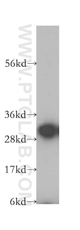 Western Blot (WB) analysis of human brain tissue using CAPZA1 Polyclonal antibody (11806-1-AP)