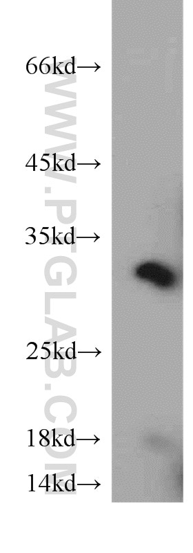 Western Blot (WB) analysis of mouse brain tissue using CAPZA1 Polyclonal antibody (55145-1-AP)