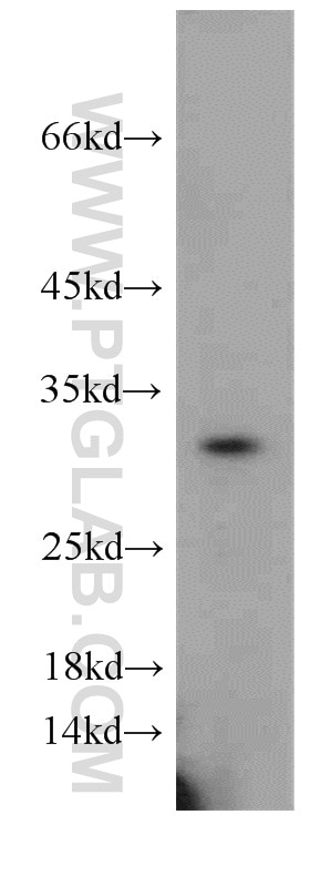 Western Blot (WB) analysis of mouse heart tissue using CAPZA1 Polyclonal antibody (55145-1-AP)