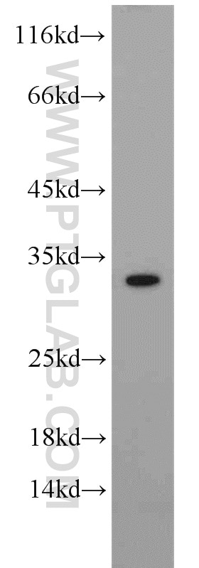 Western Blot (WB) analysis of human heart tissue using CAPZA1 Polyclonal antibody (55145-1-AP)