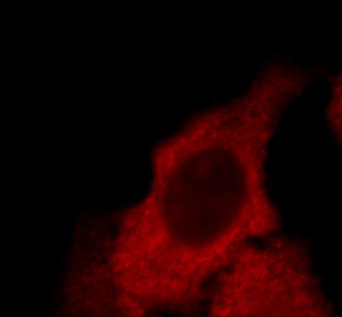 Immunofluorescence (IF) / fluorescent staining of MCF-7 cells using CAPZA1 Monoclonal antibody (66066-1-Ig)