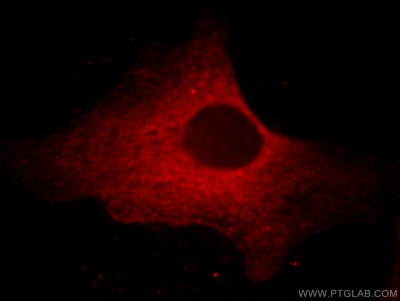Immunofluorescence (IF) / fluorescent staining of HeLa cells using CAPZA1 Monoclonal antibody (66066-1-Ig)