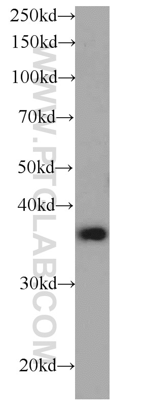 Western Blot (WB) analysis of Jurkat cells using CAPZA1 Monoclonal antibody (66066-1-Ig)